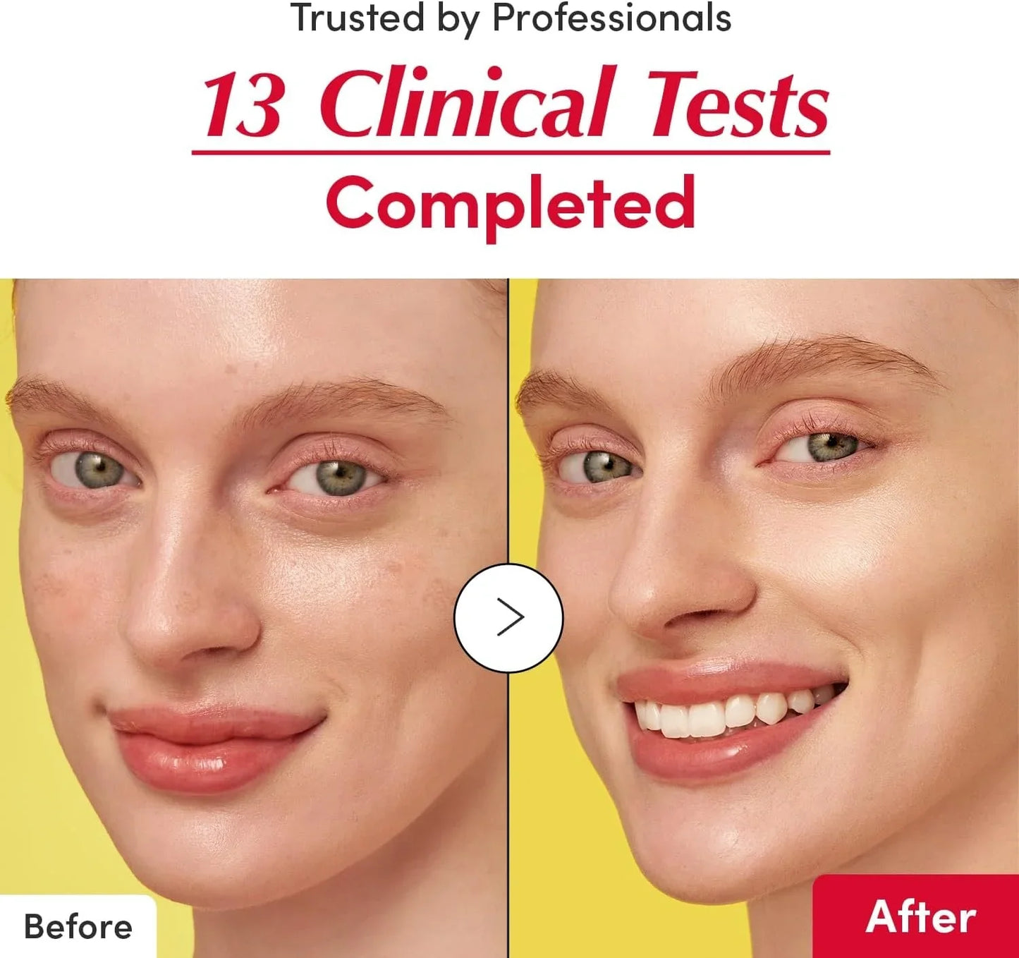 Eqqualberry Vitamin illuminating Serum 30ml