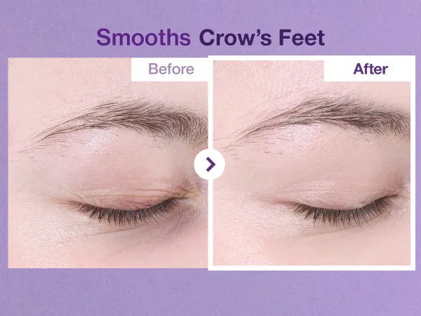 NUMBUZIN No.9 NAD Retinol Volumetox Eye Cream 10ml