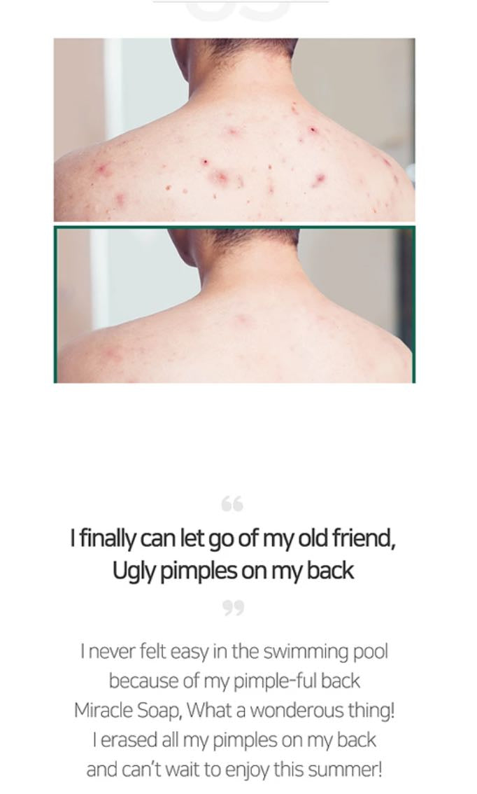 SOMEBYMI - AHA BHA PHA 30 Days Miracle Cleansing Bar