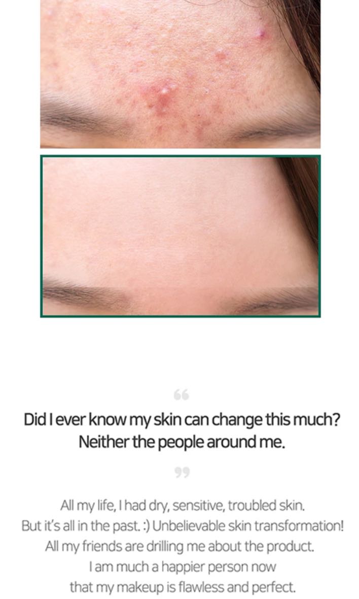 SOMEBYMI - AHA BHA PHA 30 Days Miracle Cleansing Bar