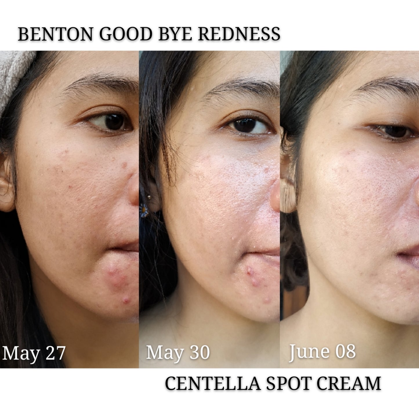 BENTON - Goodbye Redness Centella Spot Cream 15g