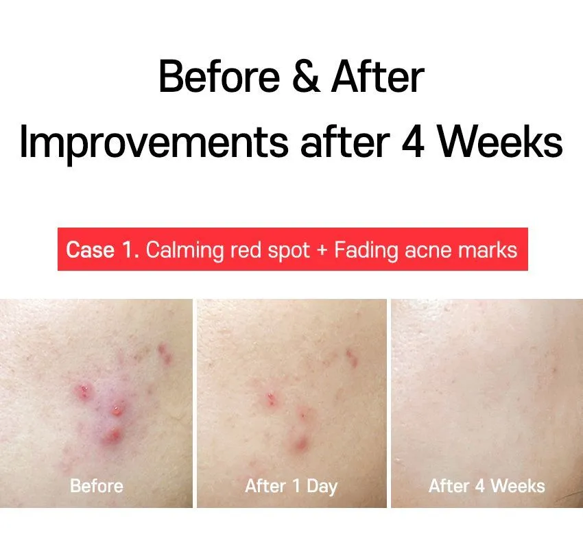 TIA'M - AC Fighting Spot RX Cream 30g