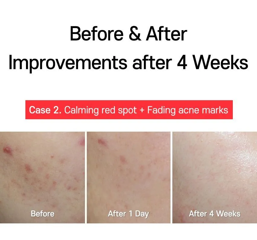 TIA'M - AC Fighting Spot RX Cream 30g