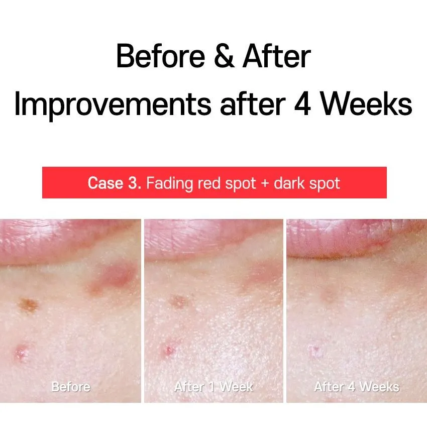 TIA'M - AC Fighting Spot RX Cream 30g