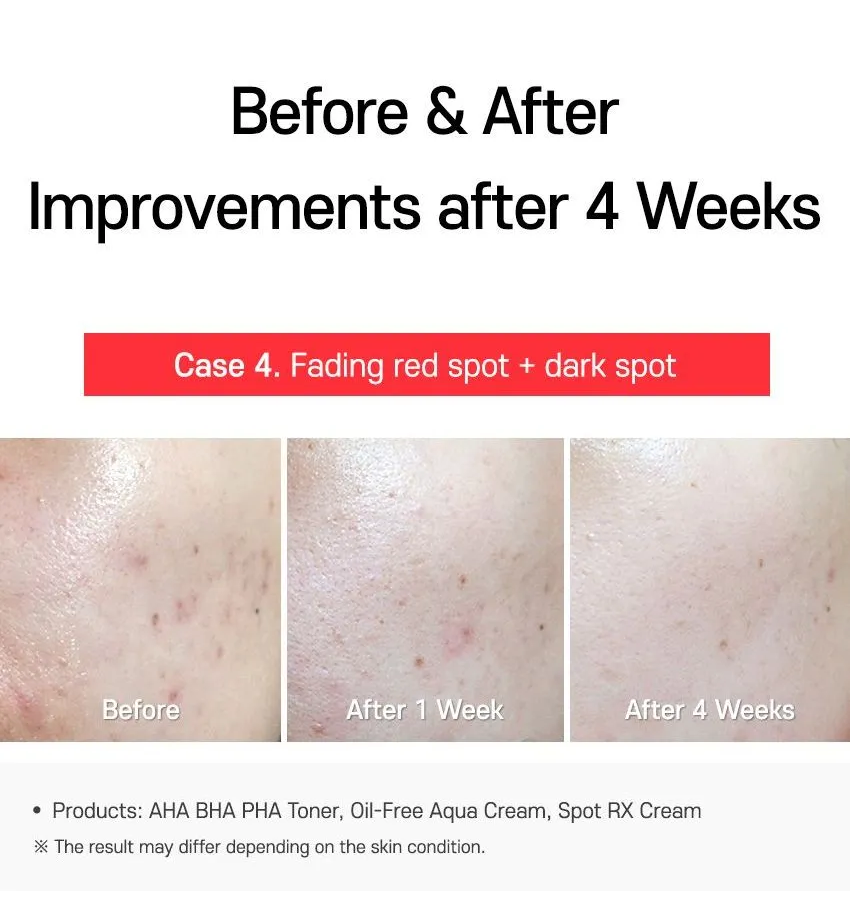 TIA'M - AC Fighting Spot RX Cream 30g