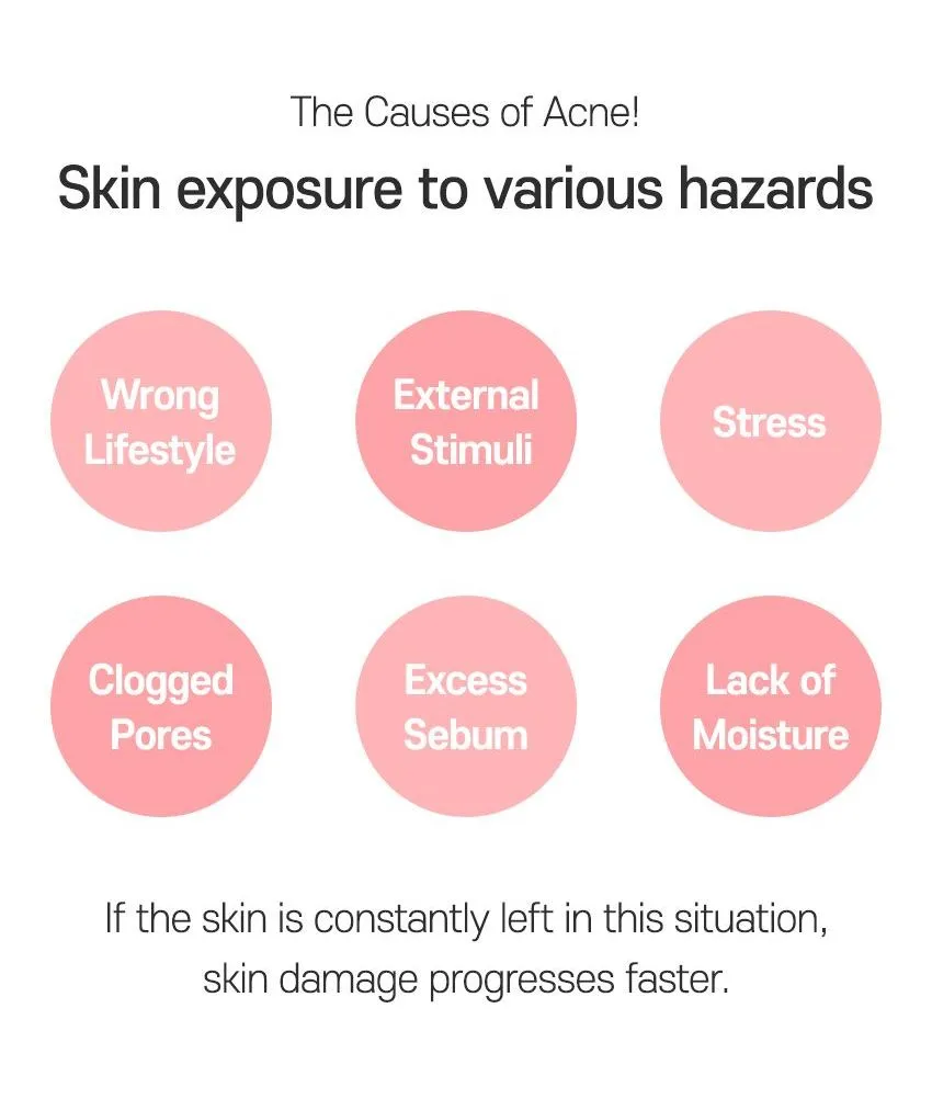 TIA'M - AC Fighting Spot RX Cream 30g