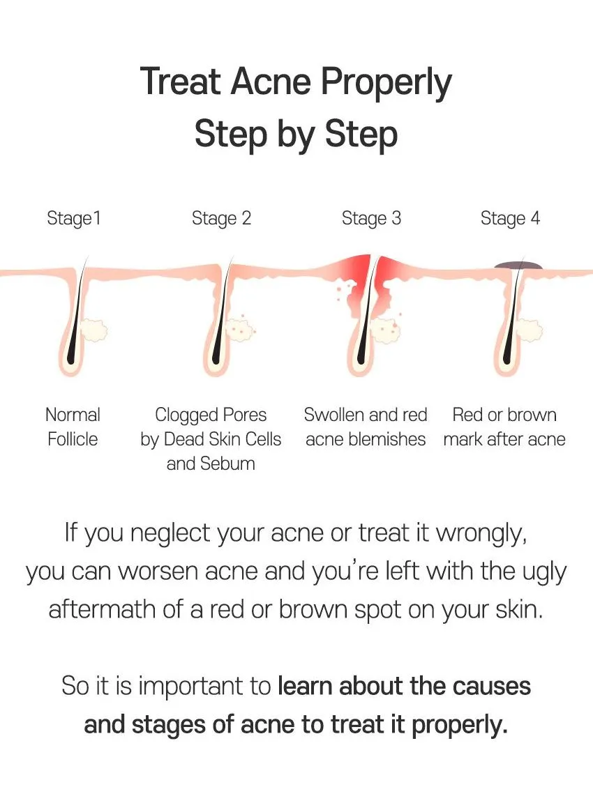 TIA'M - AC Fighting Spot RX Cream 30g