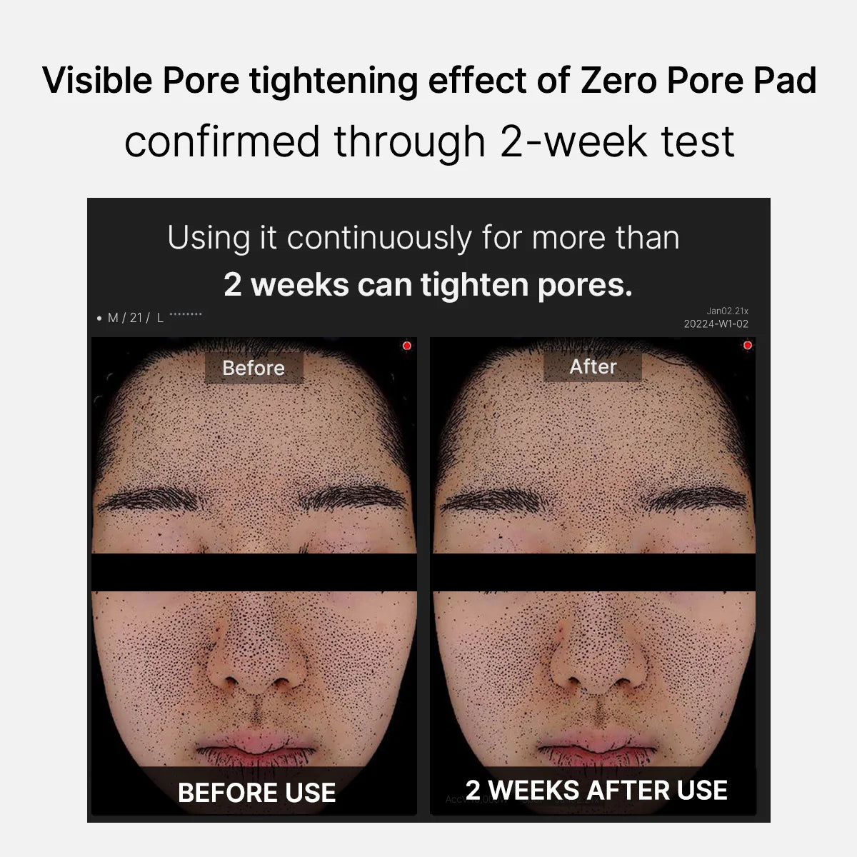 Medicube Zero Pore Pad 2.0 70P