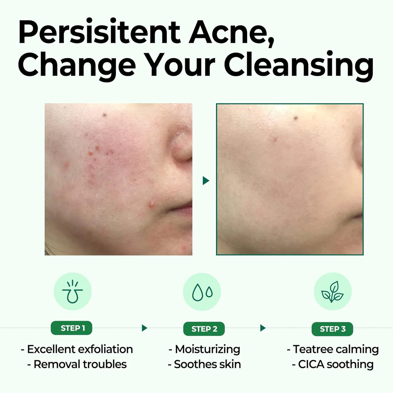 SOMEBYMI - AHA BHA PHA 30 Days Miracle Cleansing Bar
