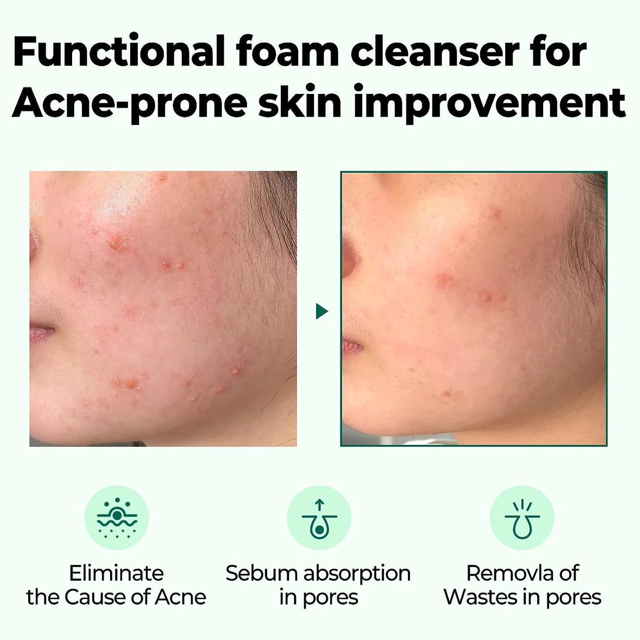 SOMEBYMI - AHA BHA PHA 30 Days Miracle Acne Clear Foam 100ml
