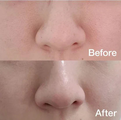 Medicube Zero Pore Pad 2.0 70P