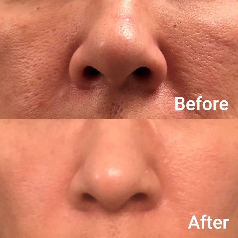 Medicube Zero Pore Pad 2.0 70P