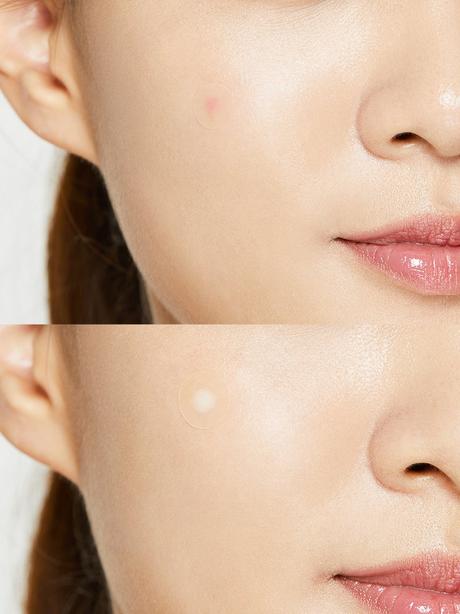 COSRX - Acne Pimple Master Patch 24pc